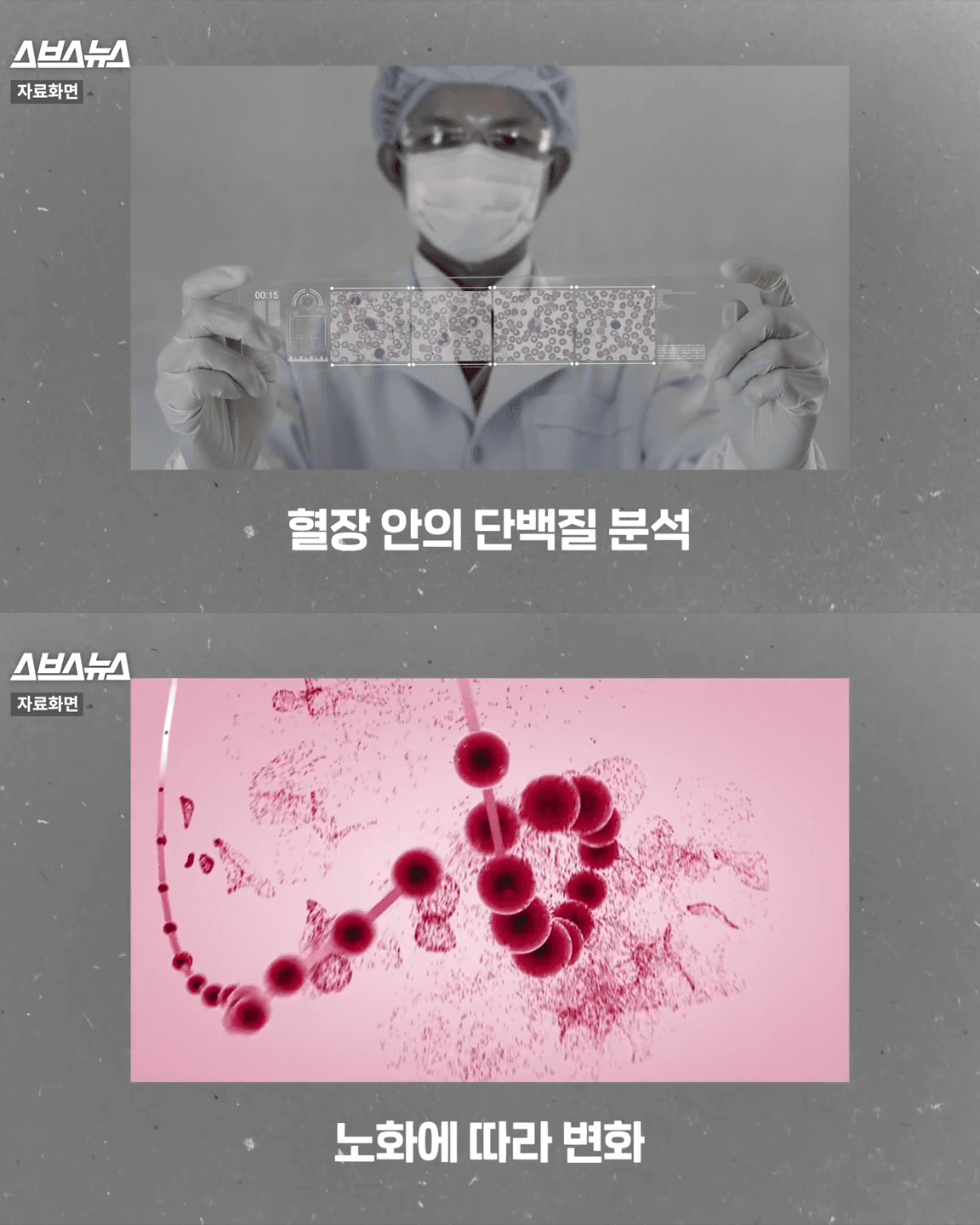 30대 중반부터 갑자기 확 늙는 이유