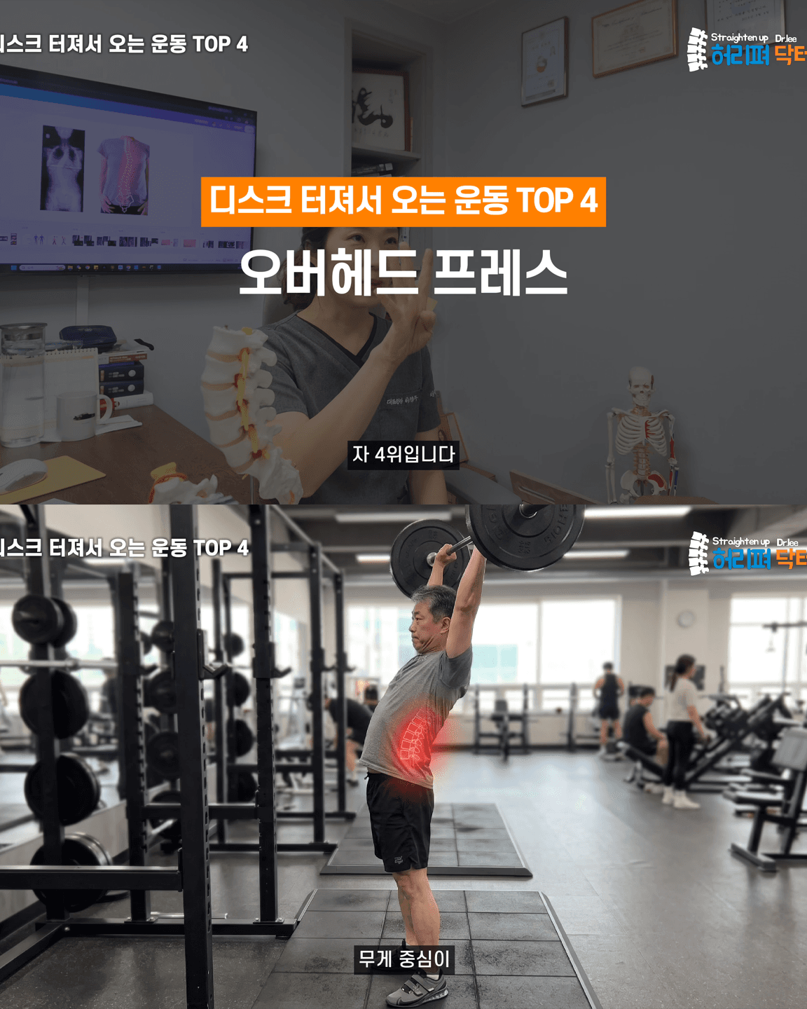 척추의사가 말하는 허리 나가는 운동