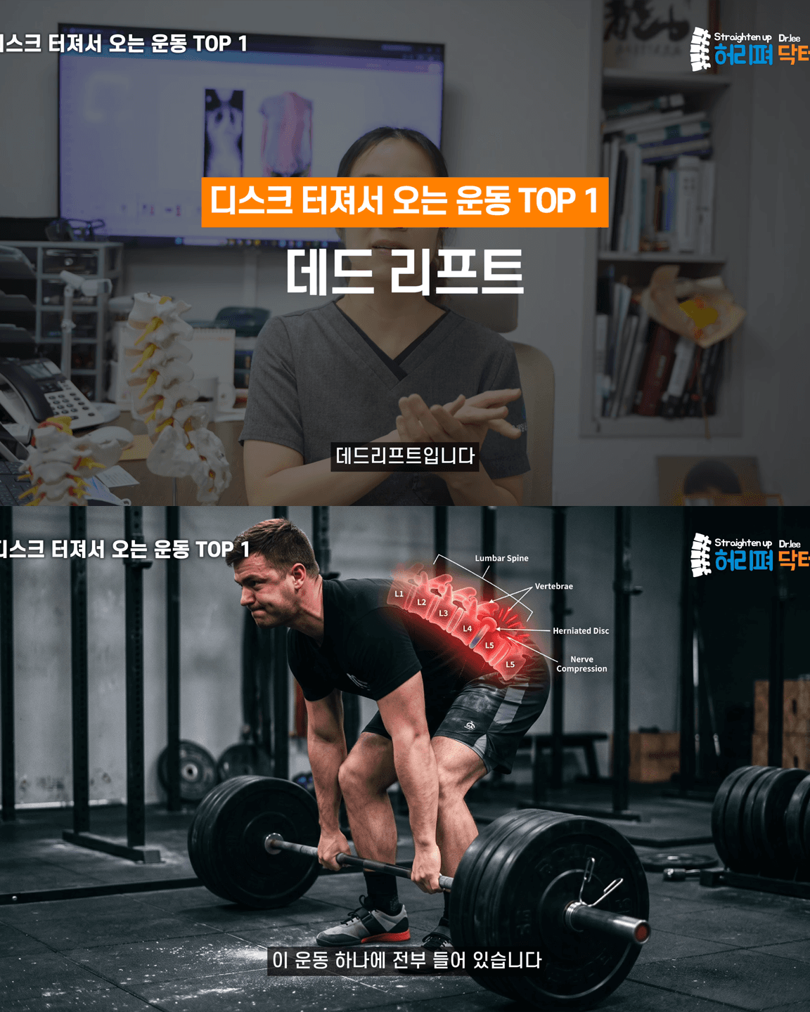 척추의사가 말하는 허리 나가는 운동