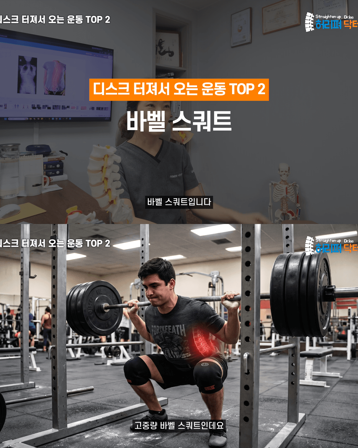 척추의사가 말하는 허리 나가는 운동