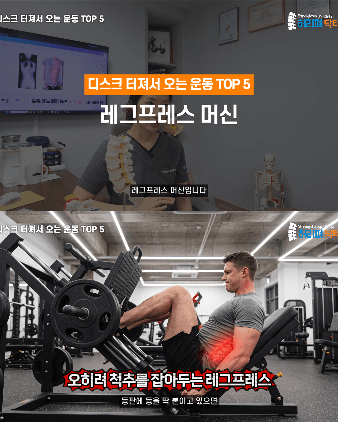 척추의사가 말하는 허리 나가는 운동