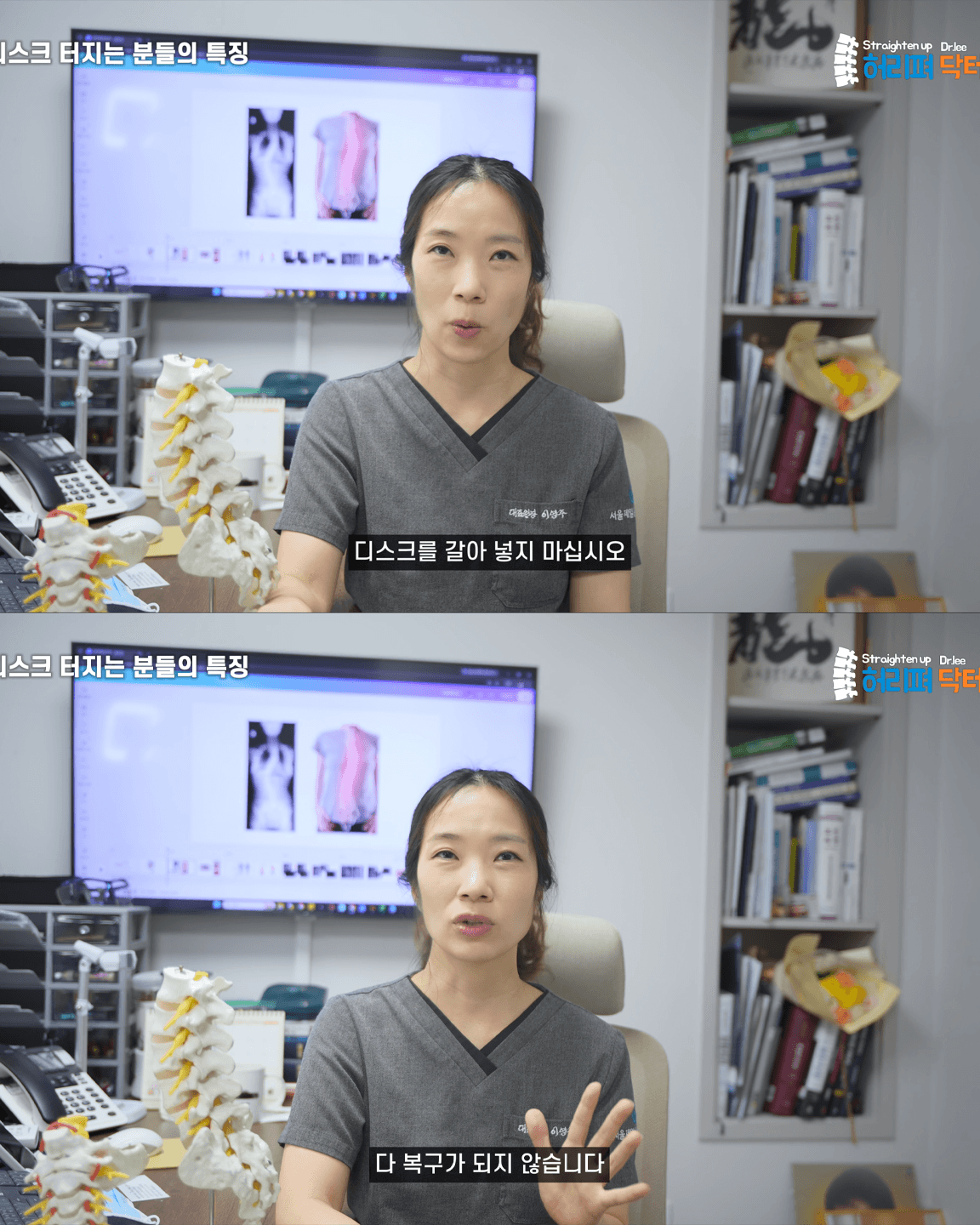 척추의사가 말하는 허리 나가는 운동