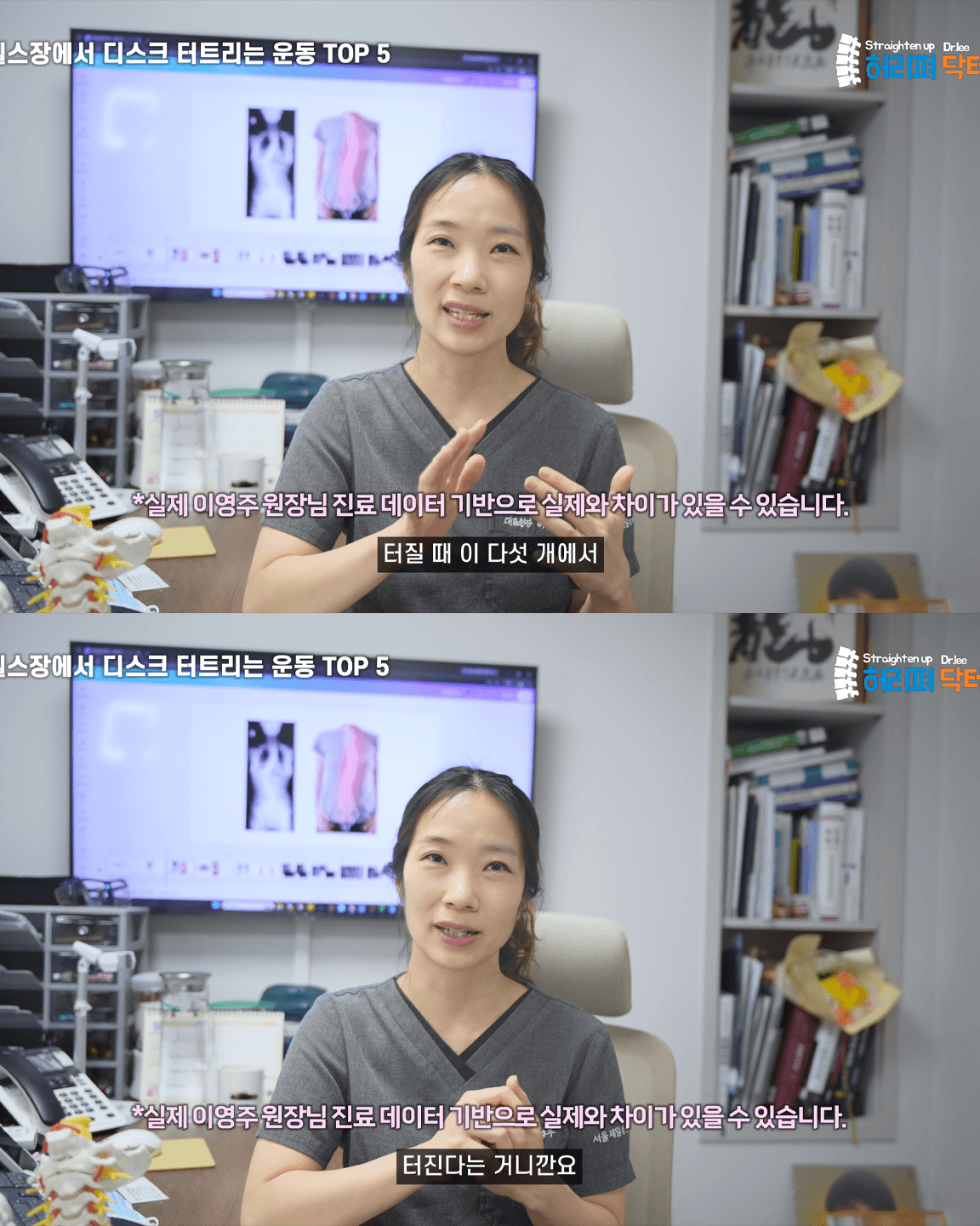 척추의사가 말하는 허리 나가는 운동