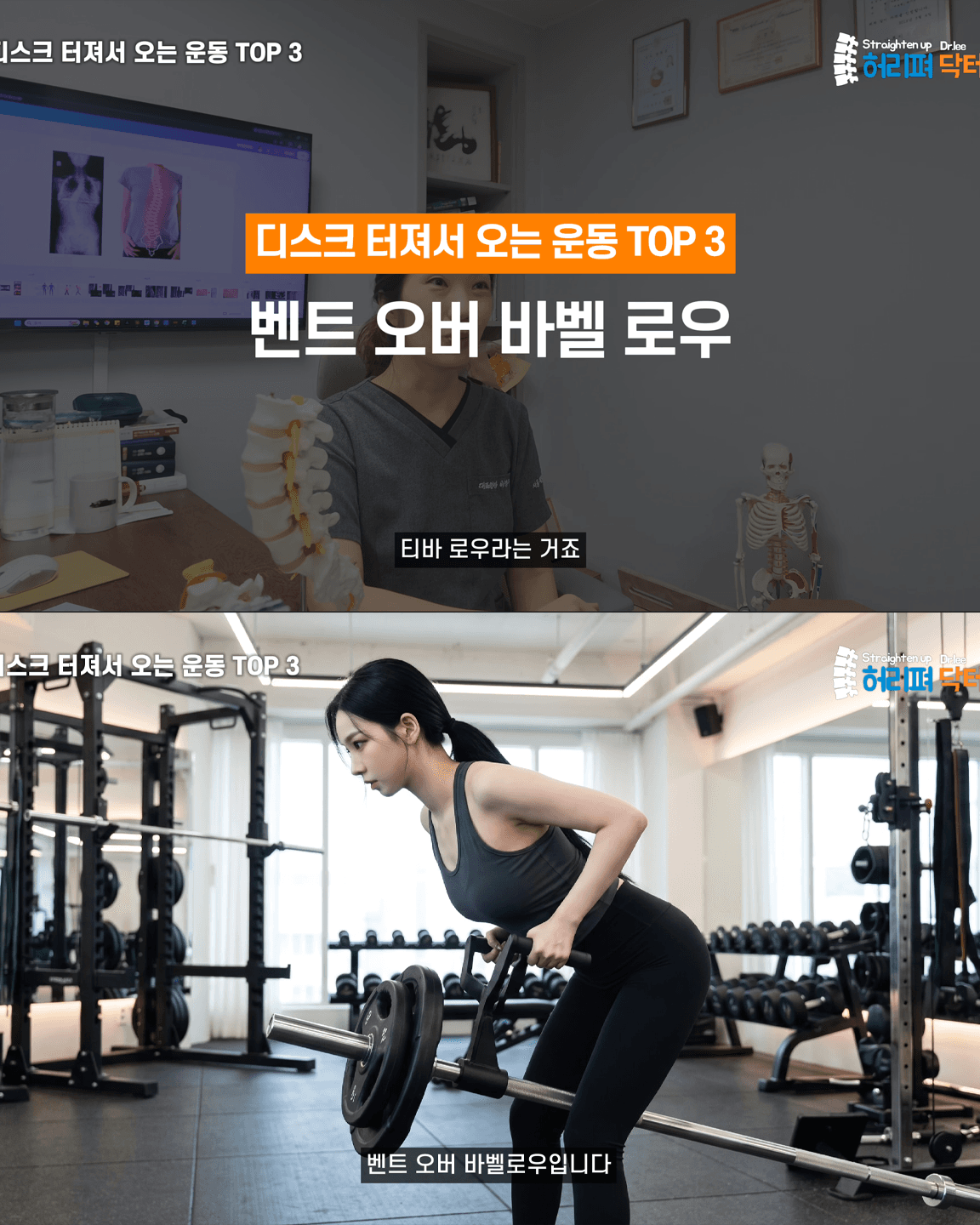 척추의사가 말하는 허리 나가는 운동